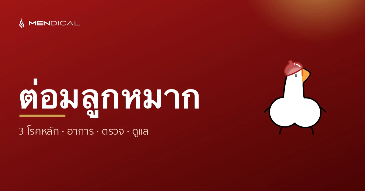 โรคต่อมลูกหมาก — โต อักเสบ มะเร็ง ต่างกันอย่างไร? อาการ วิธีตรวจ และการดูแล (คู่มือฉบับเต็ม)