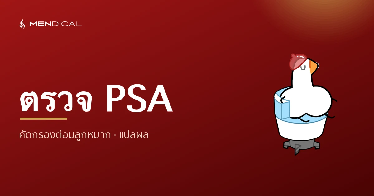 ตรวจ PSA คืออะไร? คัดกรองมะเร็งต่อมลูกหมาก ควรตรวจตอนไหน แปลผลอย่างไร